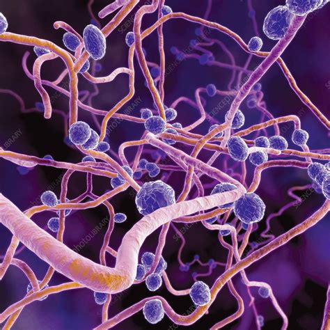 Fungal infection - Stock Image - M230/0353 - Science Photo Library