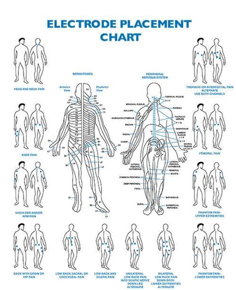 Electrode Placement | TENSProducts.com