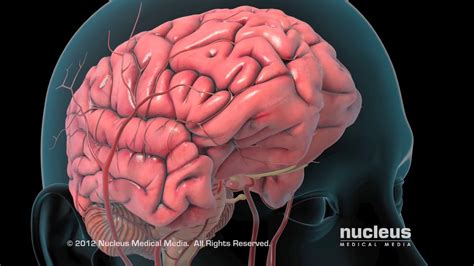 Ischemic Stroke Animation - Cook Children's - YouTube