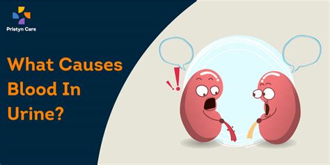 What Causes Blood in Urine? - Pristyn Care