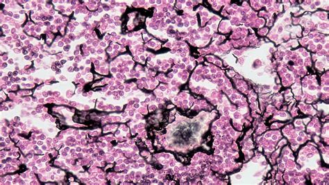 Microscopio compuesto: definición, trabajo y 5 usos importantes