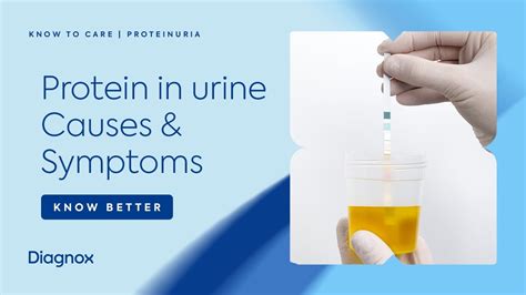 Urine Protein: Causes, Symptoms, Diagnosis, And Treatment A