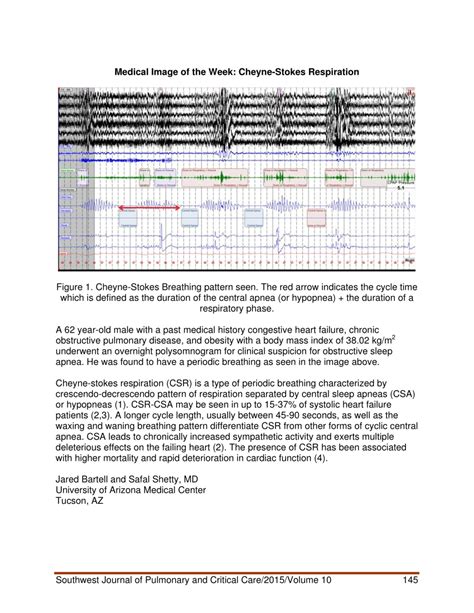 (PDF) Medical image of the week: Cheyne-Stokes respiration