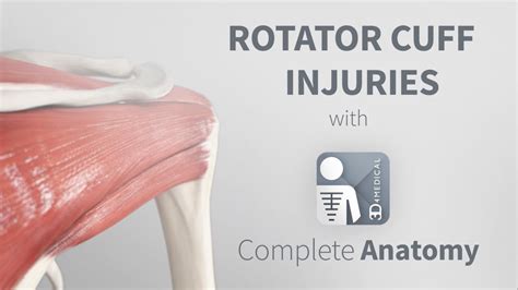 Rotator Cuff Injury Types