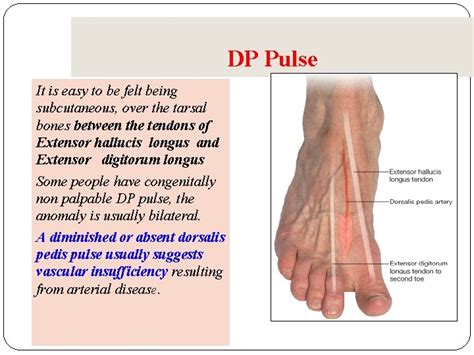 Location Of Pedal Pulse