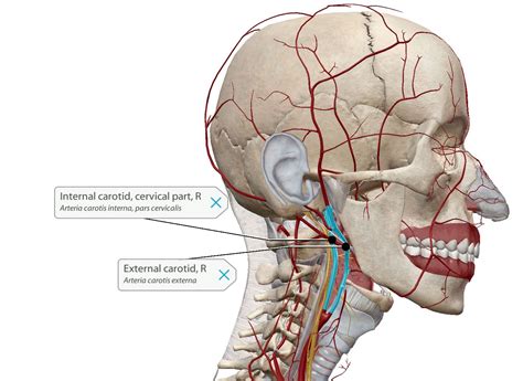 CAROTID ARTERY DISEASE: A POTENTIAL SOURCE