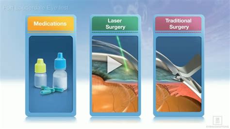 Glaucoma Treatment Options Video | Fort Lauderdale Eye Institute