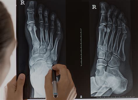 Doctor of Podiatric Surgery : The University of Western Australia