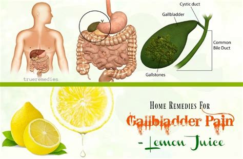 20 Quick Home Remedies For Gallbladder Pain Relief