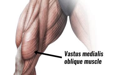 Vastus Medialis Obliquus Vmo Strengthening Exercises - Exercise Poster