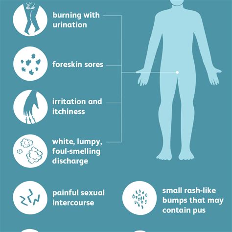 Male Yeast Infection Causes and Symptoms