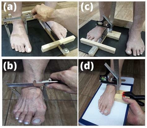 Morphology and anthropometric measurements to quantify the foot ...