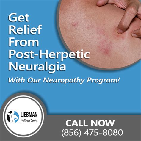 Post-Herpetic Neuralgia South Jersey | Get Post-Herpetic Neuralgia Relief!