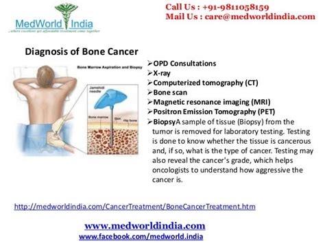 Best Cancer Hospitals of India for Advanced Bone Cancer Treatment