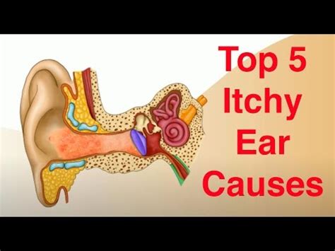 Top 5 Causes of the Itchy Ear [VIDEO] | Fauquier ENT Blog