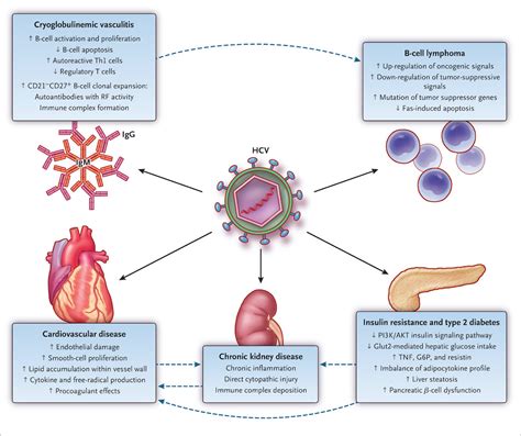 Core Concepts - Extrahepatic Conditions Related to HCV Infection ...