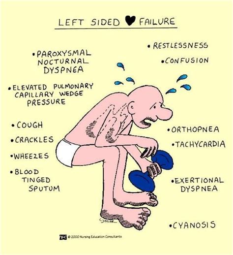 Symptoms of right sided heart failure vs left