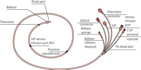 2: The nuts and bolts of right heart catheterization and PA catheter ...