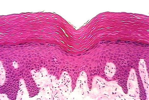 Keratinized Stratified Squamous Epithelium - Anyatrust