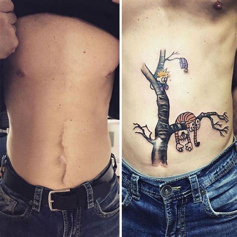 Clever tattoo designs that turn scars into beautiful works of art