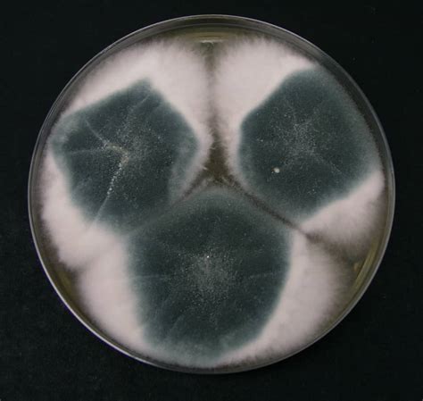 Preparation of Sabouraud Dextrose Agar (SDA) medium in Laboratory