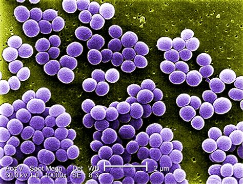 Klasifikasi Dan Morfologi Bakteri Staphylococcus Aureus Kumpulan | The ...