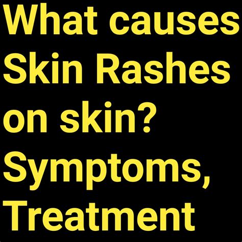 Causes Of Skin Rashes