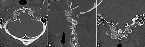 Surgical Neurology International