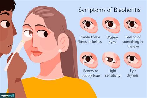 Blepharitis: Types, Symptoms, Causes, and Treatment