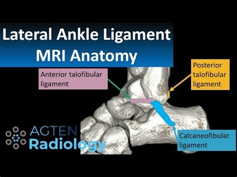 Ankle Anatomy Mri - Anatomical Charts & Posters