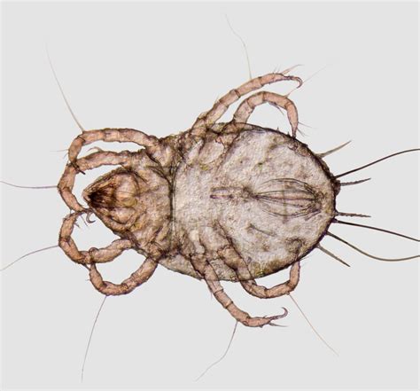 What Do Carpet Mite Bites Look Like - Carpet Vidalondon