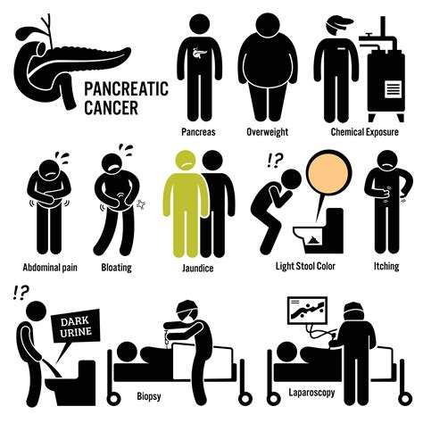 Pancreatic Cancer Symptoms and Treatment | CyberKnife Miami