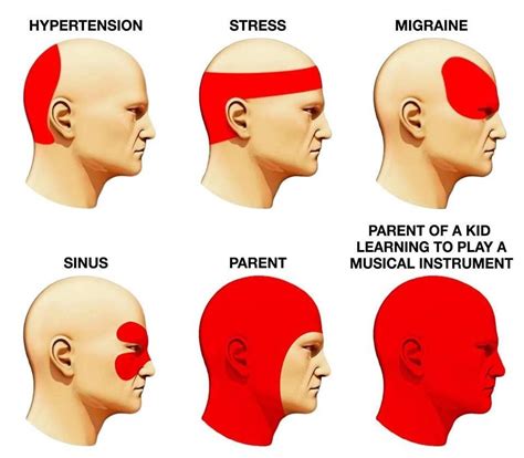 Different Headache Types Chart