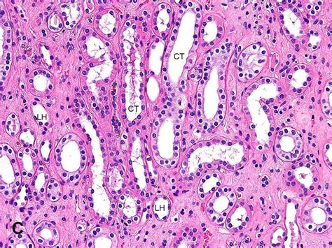 Collecting Ducts Kidney Histology