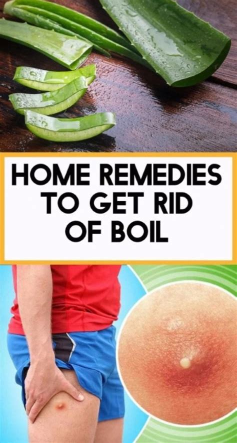 HOME REMEDIES TO GET RID OF BOIL!.. | Remedies, Natural remedies, Health