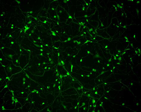 Cortical GABAergic Neurons — BrainXell