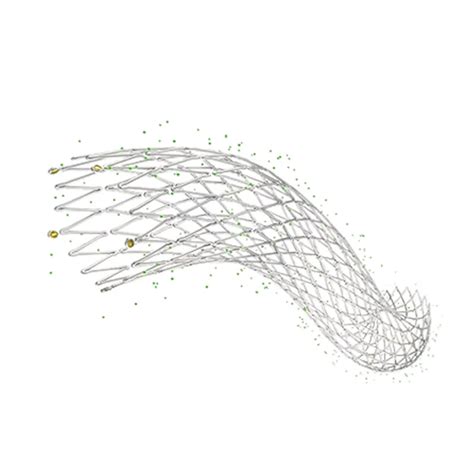 Iliac Artery Stent