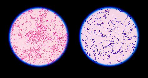 Gram Staining Under Microscope