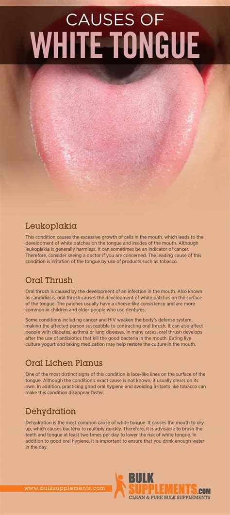 White Tongue: Symptoms, Causes & Treatment