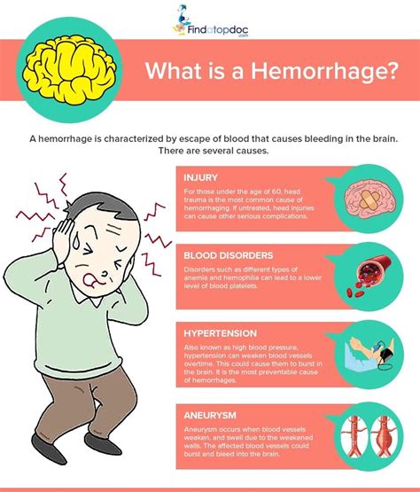 Intracranial Hemorrhage: Symptoms, Causes, Treatment, and Diagnosis ...