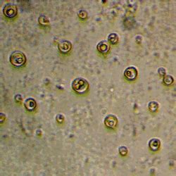 Cryptococcus neoformans in MODS plate at ×400 magnification with ...