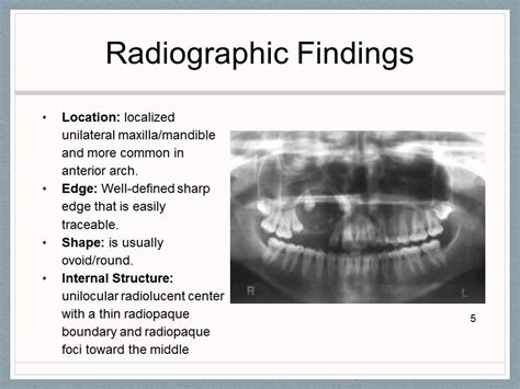 Adenomatoid Odontogenic Tumor - YouTube