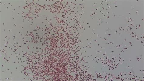 Pseudomonas Aeruginosa Gram Stain