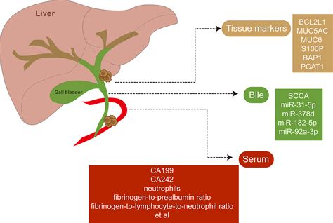 Frontiers | An overview of extrahepatic cholangiocarcinoma: from here ...