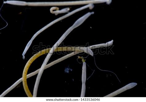 Study Acanthocephala Phylum Parasitic Worms Known Stock Photo ...