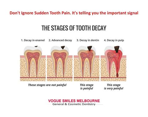 My Tooth Hurts - What Should I Do? | Relieve Tooth pain