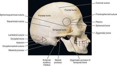 Asterion Skull