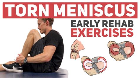 Meniscus Tear - Start With These Rehab Exercises - YouTube