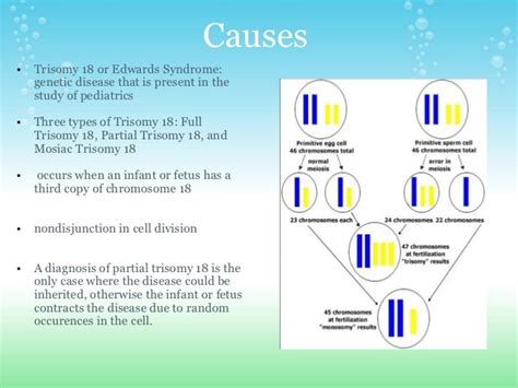 Trisomy 18