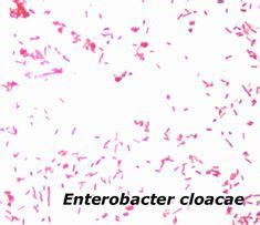 Enterobacter Aerogenes Gram Stain